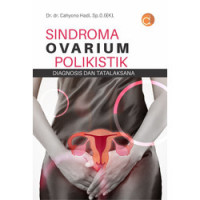 Sindroma Ovarium Polikistik
