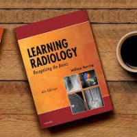 Learning Radiology : Recognizing the Basics