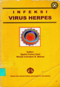 Image of Infeksi Virus Herpes