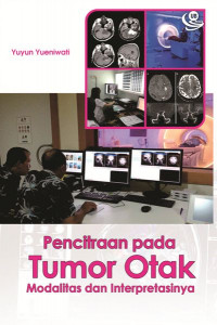 Image of Pencitraan pada Tumor Otak Modalitas dan Interpretasinya