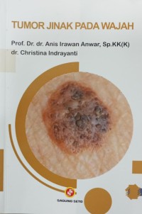 Image of Tumor Jinak Pada Wajah