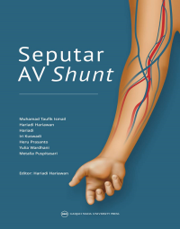 Image of Seputar Av Shunt