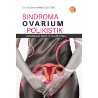 Image of Sindroma Ovarium Polikistik