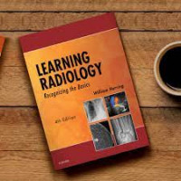 Image of Learning Radiology : Recognizing the Basics