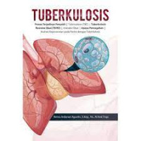 Image of Tuberkolosis