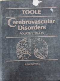 Image of Cerebrovascular Disorders