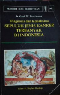 Image of Diagnosis dan Tatalaksana Sepuluh Jenis Kanker Terbanyak Di Indonesia