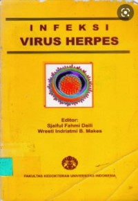 Infeksi Virus Herpes
